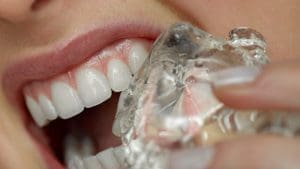 Read article: ‘Daily ice-chewing habit can have lasting consequences on your teeth’