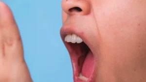 How to deal with poo breath