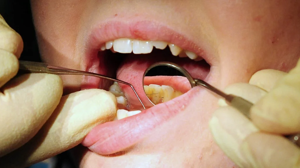 NHS dental patients suffer further decay in service thanks to NI Executive