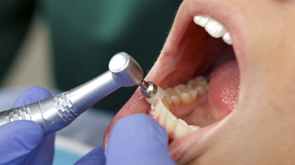 Smile makeover or risky business? Warning about unregulated dental tourism